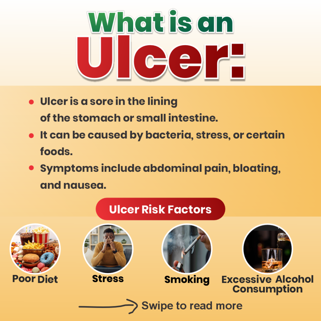 Ulcer tea carousel slide 2_095742